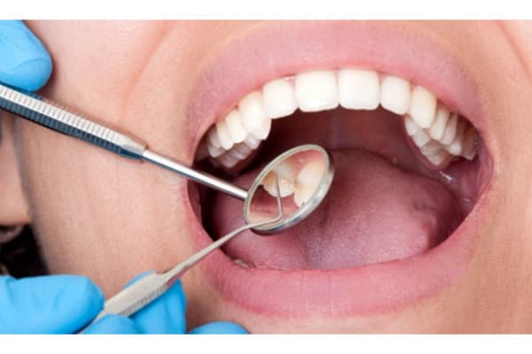 Foto de Dr. Ignacio Pluchino Scalise Odontólogo